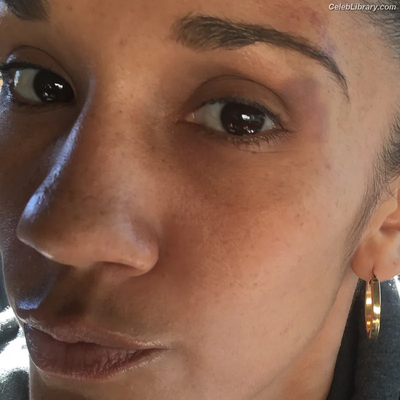 Amanda Serrano photo 9 of 153