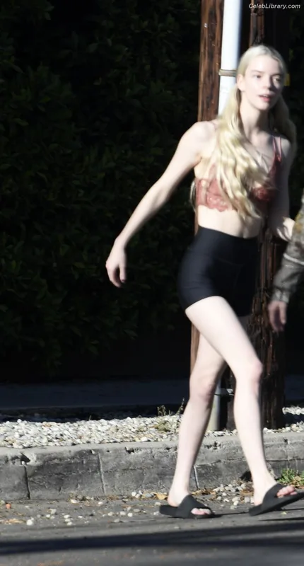 Anya Taylor-Joy photo 2 of 1440