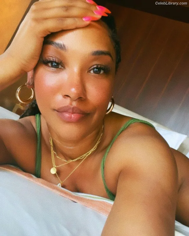 Candice patton photo 4 of 112