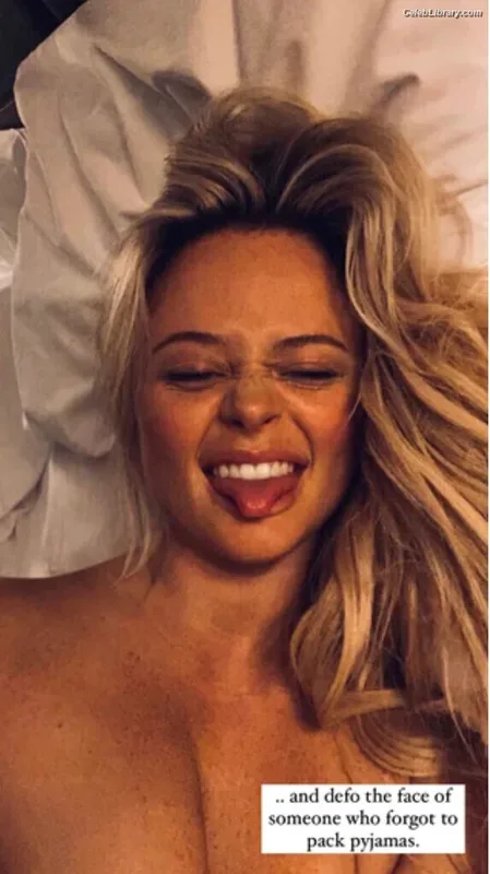 Emily Atack photo 2 of 578