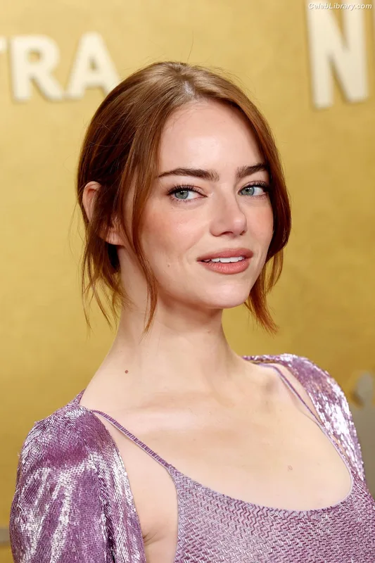 Emma Stone photo 11 of 1455