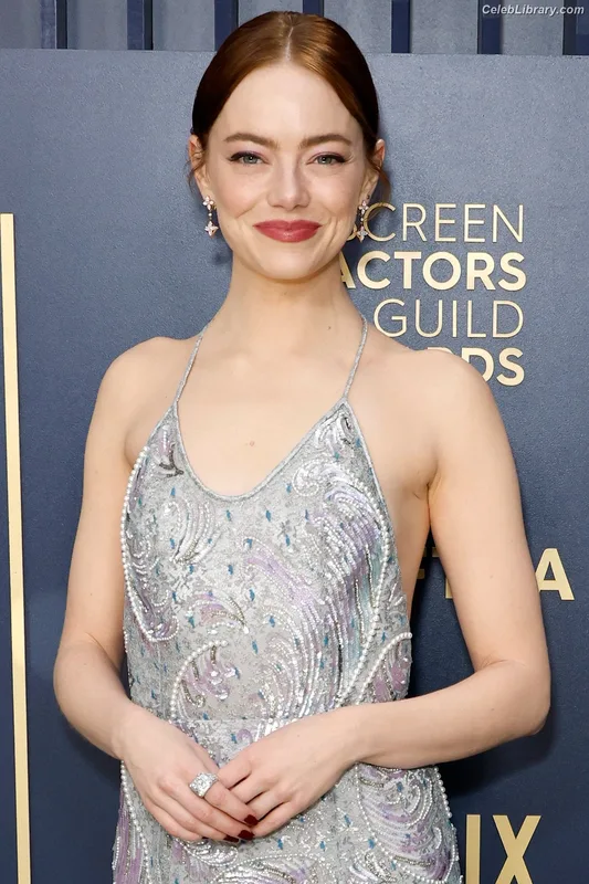 Emma Stone photo 12 of 1455