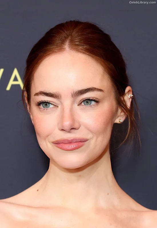 Emma Stone photo 17 of 1455