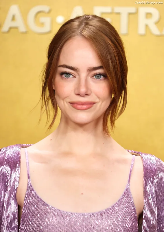 Emma Stone photo 5 of 1455