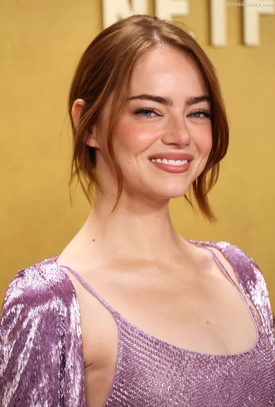 Emma Stone photo 6 of 1455