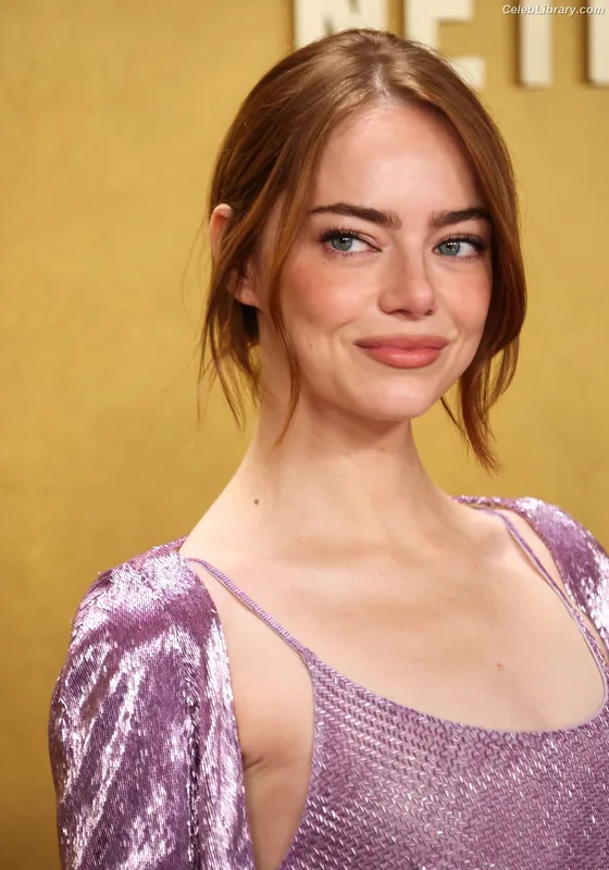 Emma Stone photo 7 of 1455