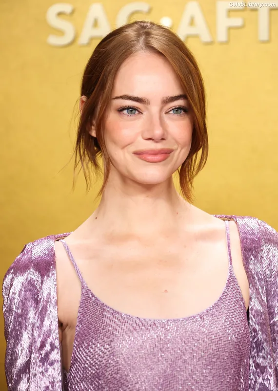 Emma Stone photo 10 of 1455