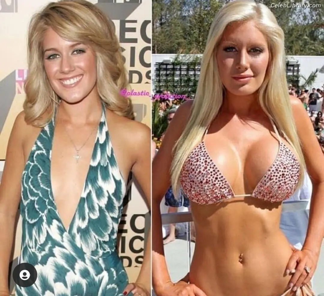 Heidi Montag photo 21 of 591