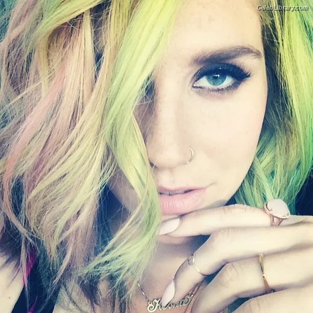 Kesha photo 6 of 576