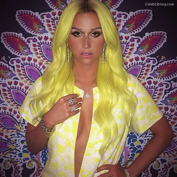 Kesha photo 13 of 576