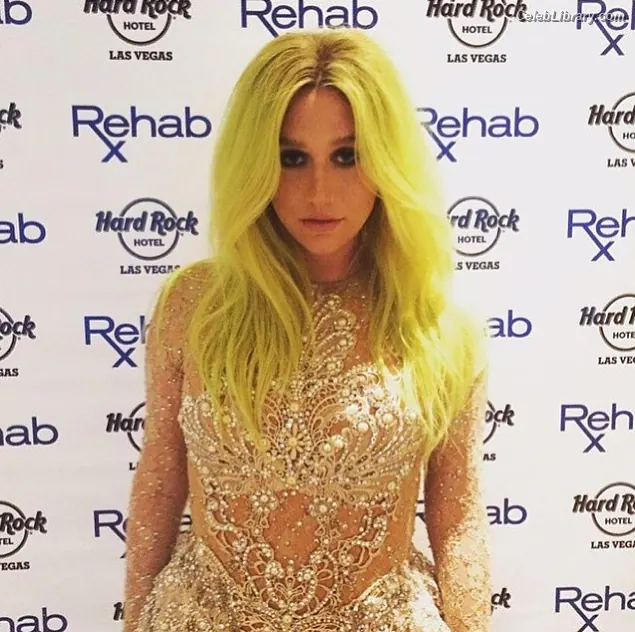 Kesha photo 13 of 576