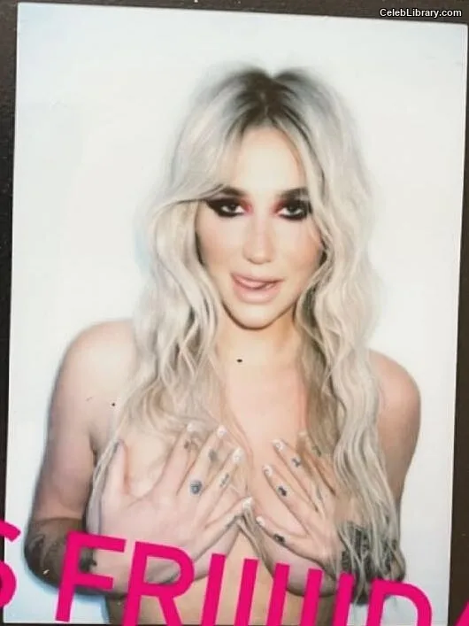 Kesha photo 16 of 577