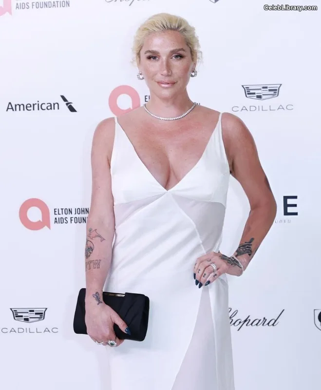Kesha photo 2 of 577