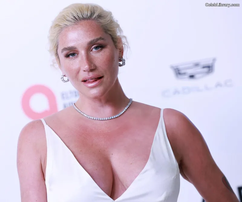 Kesha photo 3 of 577