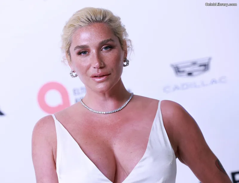Kesha photo 4 of 577