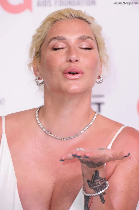 Kesha photo 5 of 577