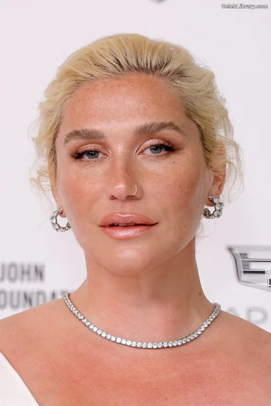 Kesha photo 6 of 577