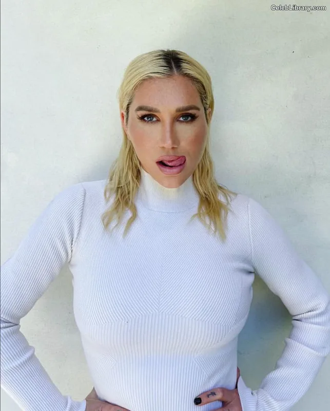 Kesha photo 14 of 577