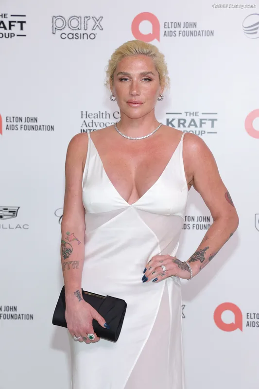 Kesha photo 16 of 577