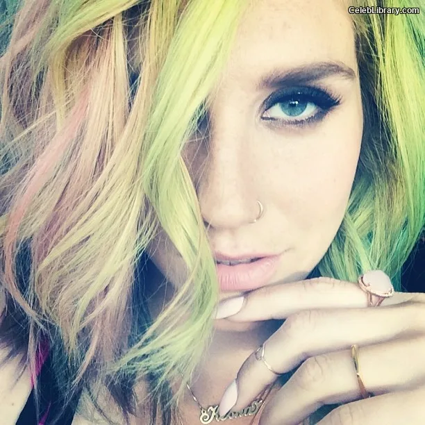 Kesha photo 13 of 577