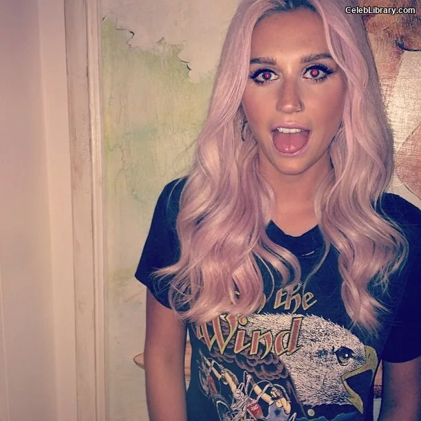 Kesha photo 16 of 577