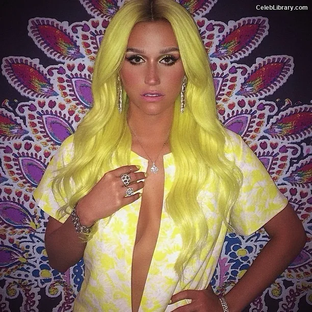 Kesha photo 20 of 577