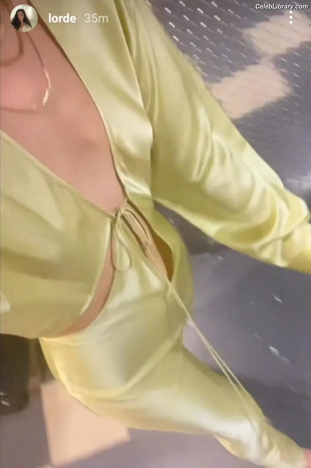 Lorde photo 20 of 543
