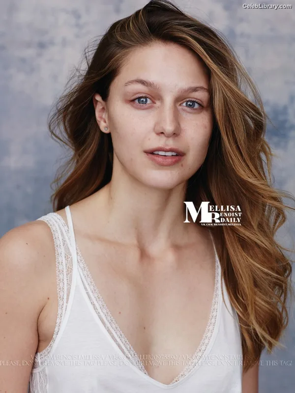 Melissa Benoist photo 1 of 361
