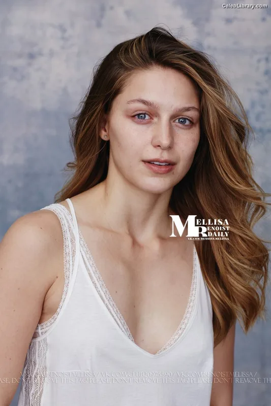 Melissa Benoist photo 4 of 361