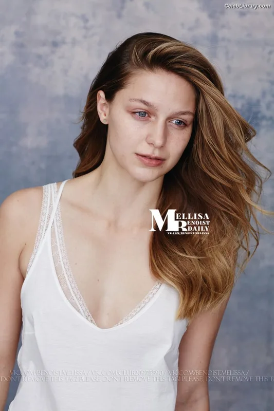 Melissa Benoist photo 8 of 361