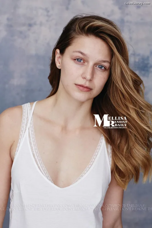 Melissa Benoist photo 13 of 361