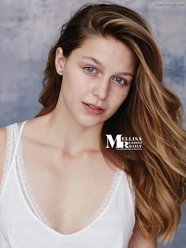 Melissa Benoist photo 24 of 361