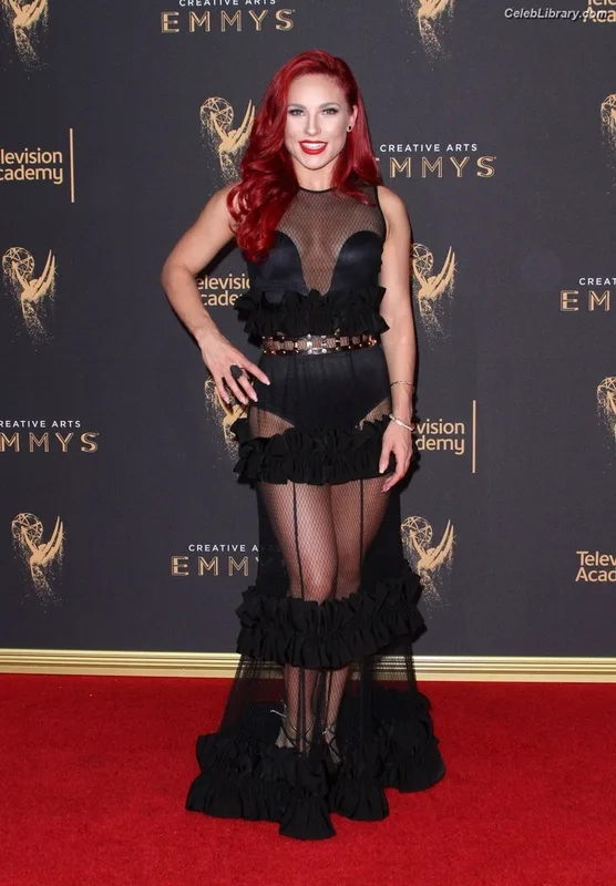Sharna Burgess photo 3 of 26