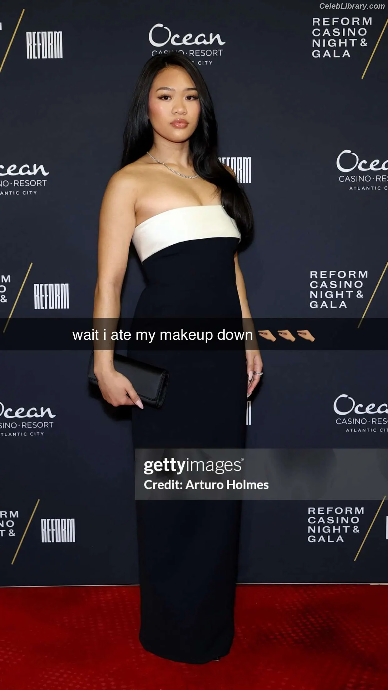 Suni Lee photo 10 of 1002