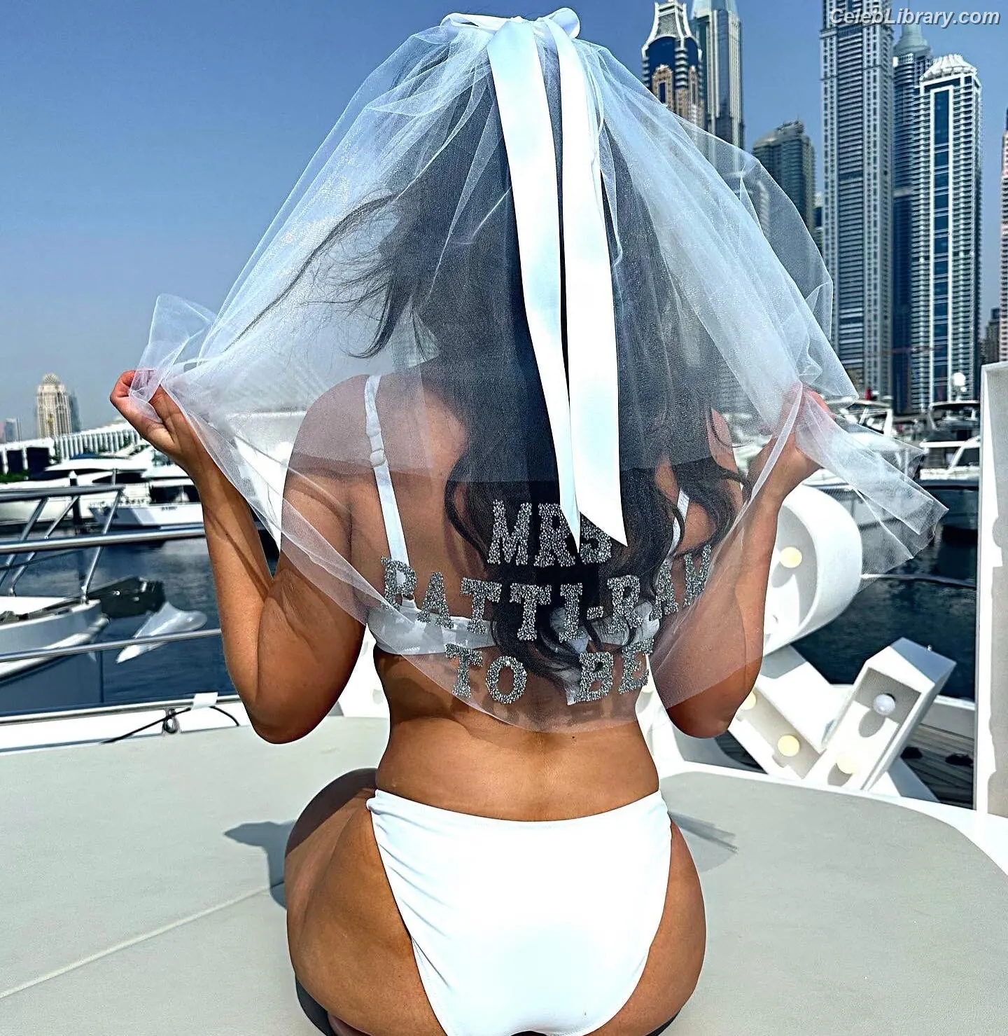 Vicky Pattison photo 2 of 133