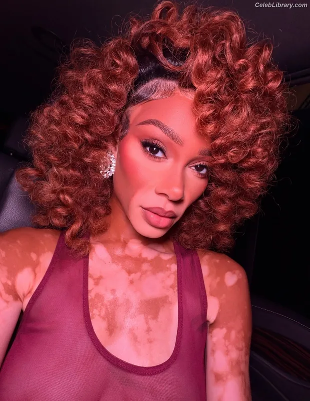 Winnie Harlow photo 6 of 56