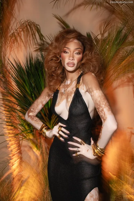 Winnie Harlow photo 11 of 56