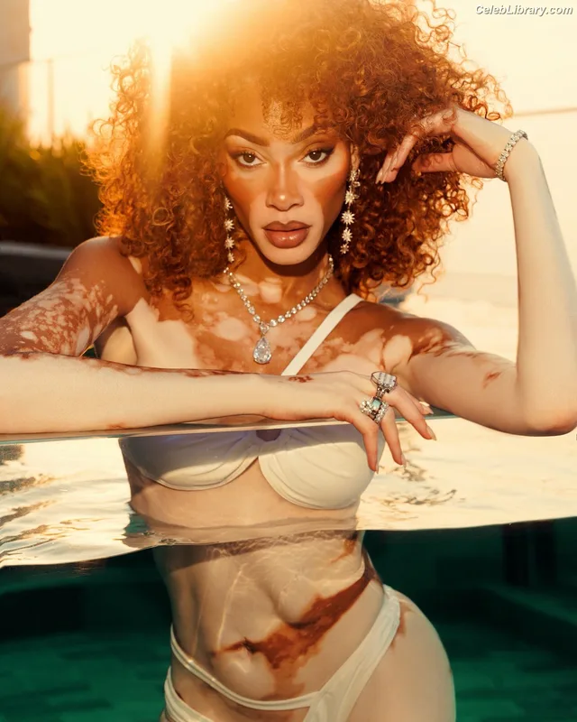 Winnie Harlow photo 12 of 56