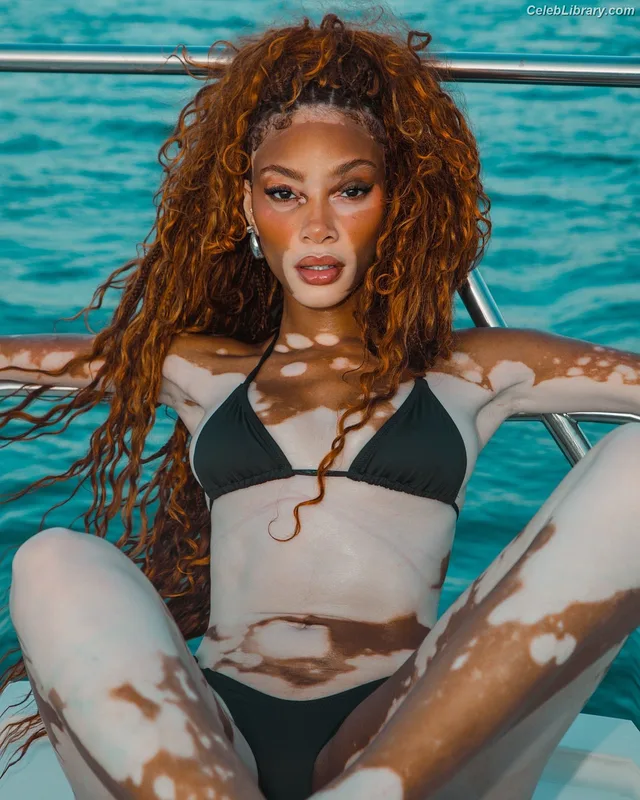 Winnie Harlow photo 16 of 56