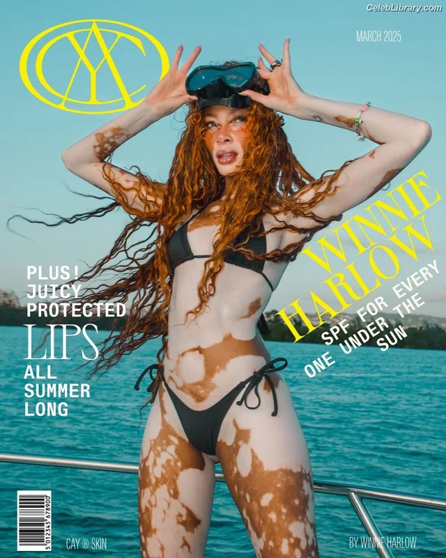 Winnie Harlow photo 17 of 56