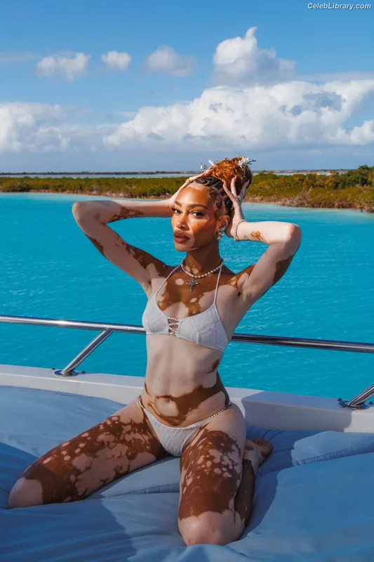 Winnie Harlow photo 20 of 56