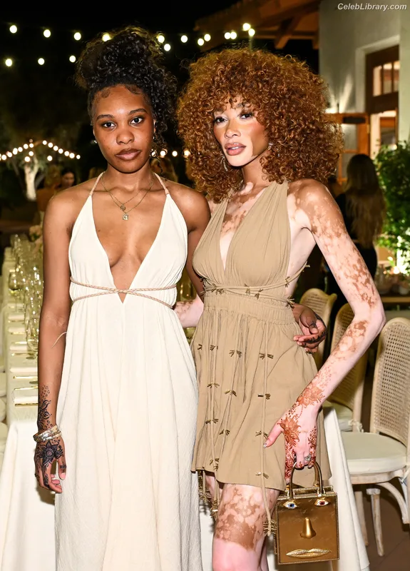 Winnie Harlow photo 1 of 56