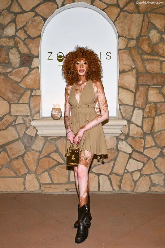 Winnie Harlow photo 8 of 56