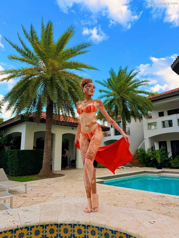 Winnie Harlow photo 16 of 56