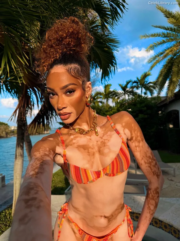 Winnie Harlow photo 17 of 56