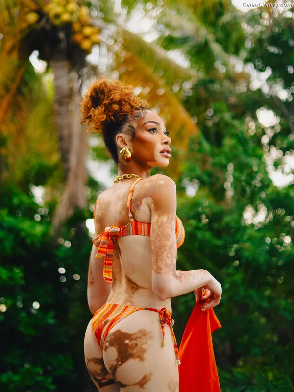 Winnie Harlow photo 18 of 56
