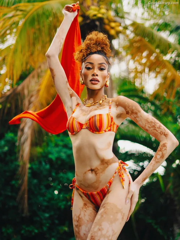 Winnie Harlow photo 20 of 56