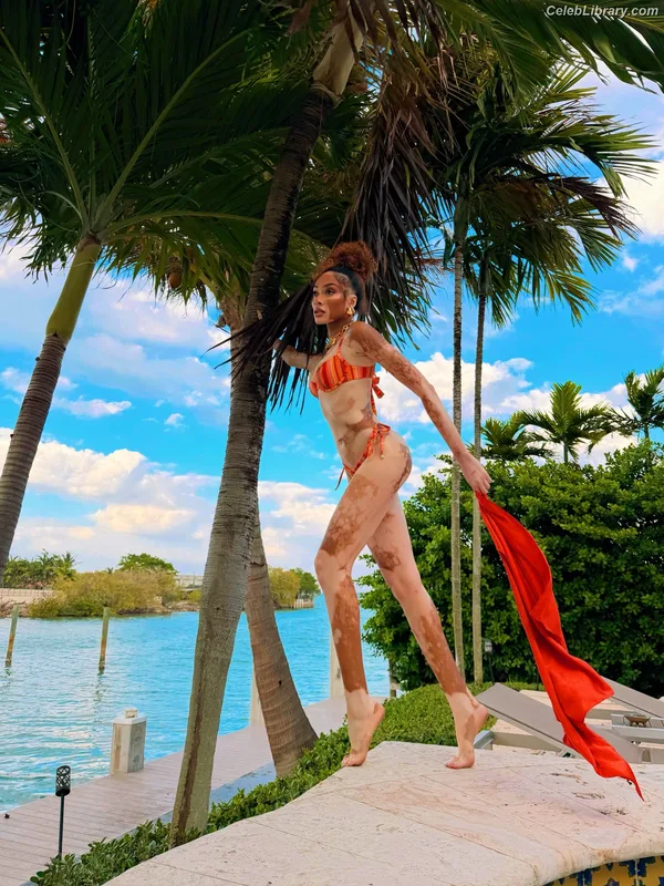 Winnie Harlow photo 21 of 56