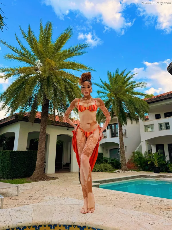 Winnie Harlow photo 22 of 56