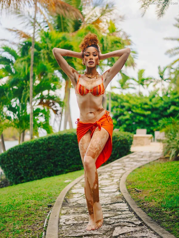 Winnie Harlow photo 24 of 56